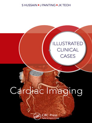 cover image of Cardiac Imaging